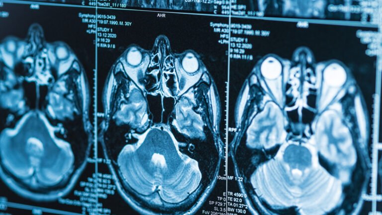 cerebro mujer violada